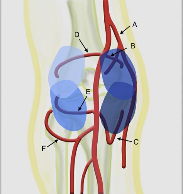 Why choose Genicular artery embolization (GAE )