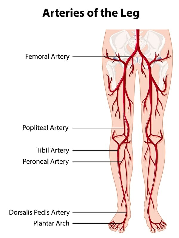 Arterial Treatments - Peripheral arterial disease (PAD) treatments