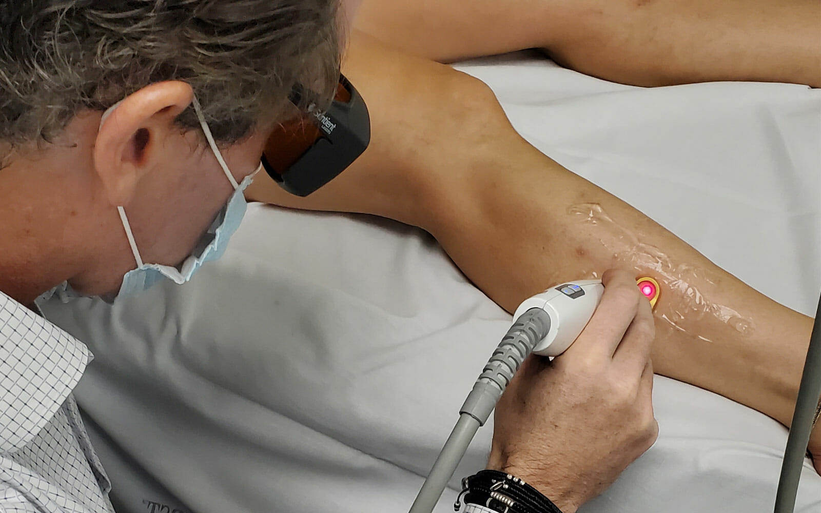Doctor uses the cutera excel v laser to treat vascular disease in patient's leg.
