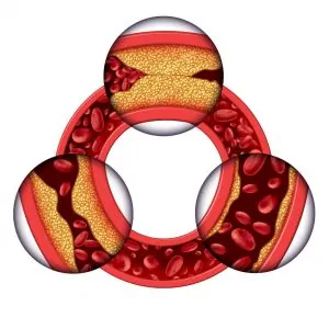 pad treatments