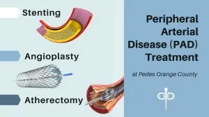 PAD treatment 