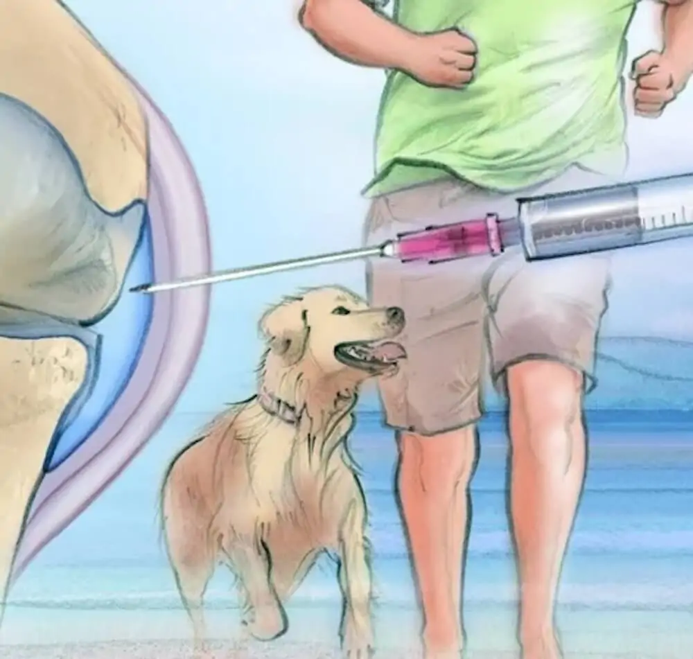 knee osteoarthritis treatment